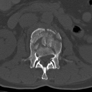Spine Surgery Board Review 2009: High-Yield MCQs (Set 2) - Figure 9