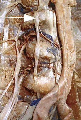 Spine Surgery 2009 Practice Questions: Set 3 (Solved) - Figure 11