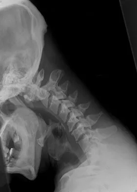 Spine Surgery 2009 Practice Questions: Set 3 (Solved) - Figure 7