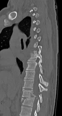 Spine Surgery Board Review 2009: High-Yield MCQs (Set 4) - Figure 5