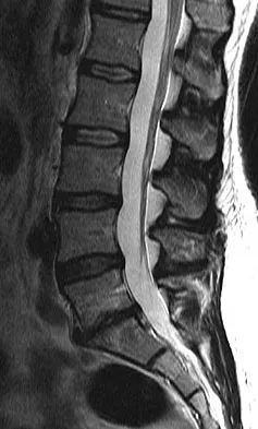 Spine Surgery Board Review 2009: High-Yield MCQs (Set 4) - Figure 9