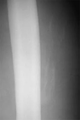 AAOS & ABOS Sports Medicine MCQs (Set 1): Knee, Shoulder & Ankle Injuries | Board Review