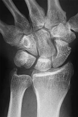 Sports Medicine 2001 Practice Questions: Set 1 (Solved) - Figure 13