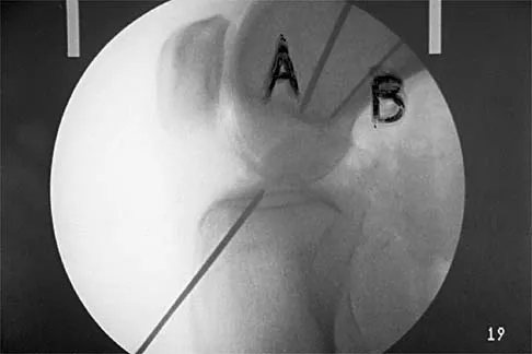 Sports Medicine 2001 Practice Questions: Set 1 (Solved) - Figure 20