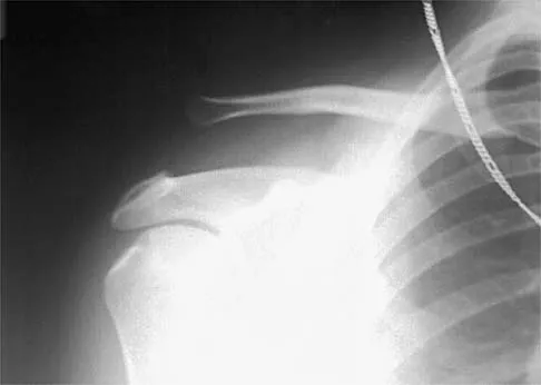 Sports Medicine 2001 Practice Questions: Set 1 (Solved) - Figure 22