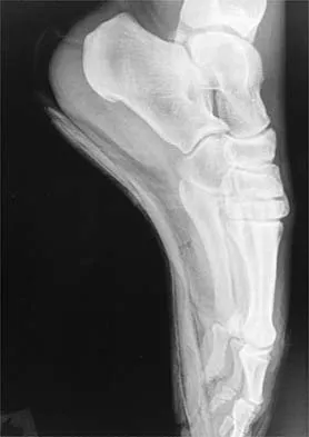 Sports Medicine 2001 Practice Questions: Set 1 (Solved) - Figure 23