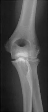 Sports Medicine 2001 Practice Questions: Set 1 (Solved) - Figure 26