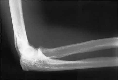 Sports Medicine 2001 Practice Questions: Set 1 (Solved) - Figure 27