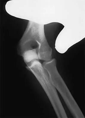 Sports Medicine 2001 Practice Questions: Set 1 (Solved) - Figure 28