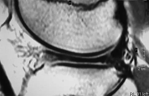 Sports Medicine 2001 Practice Questions: Set 1 (Solved) - Figure 4