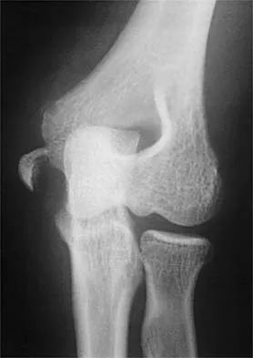 Sports Medicine 2001 Practice Questions: Set 1 (Solved) - Figure 8