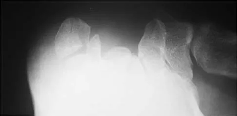 Sports Medicine Board Review 2001: High-Yield MCQs (Set 2) - Figure 10