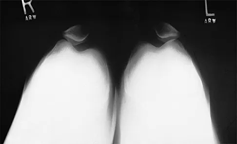 Sports Medicine Board Review 2001: High-Yield MCQs (Set 2) - Figure 19