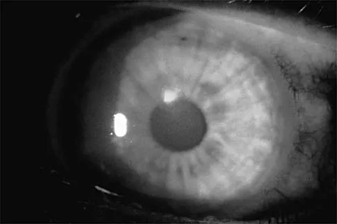 Sports Medicine Board Review 2001: High-Yield MCQs (Set 2) - Figure 20