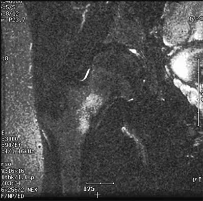 Sports Medicine Board Review 2001: High-Yield MCQs (Set 2) - Figure 25