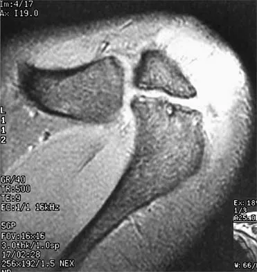 Sports Medicine Board Review 2001: High-Yield MCQs (Set 2) - Figure 5