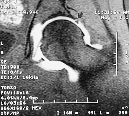 Sports Medicine Board Review 2001: High-Yield MCQs (Set 2) - Figure 6