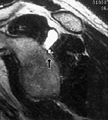 Sports Medicine Board Review 2001: High-Yield MCQs (Set 2) - Figure 7