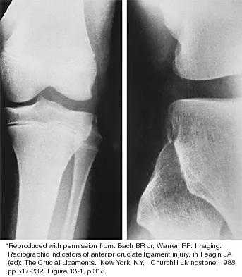 Sports Medicine 2001 Practice Questions: Set 3 (Solved) - Figure 11