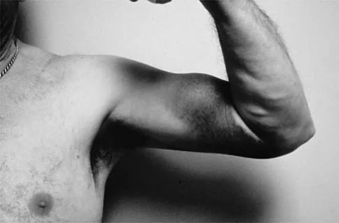 Sports Medicine 2001 Practice Questions: Set 3 (Solved) - Figure 5