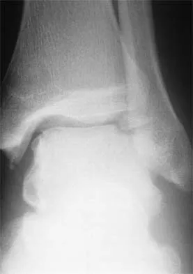 Sports Medicine 2001 Practice Questions: Set 3 (Solved) - Figure 7