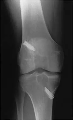 Sports Medicine Board Review 2001: High-Yield MCQs (Set 4) - Figure 13