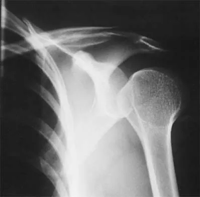 Sports Medicine Board Review 2001: High-Yield MCQs (Set 4) - Figure 4