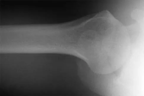 Sports Medicine Board Review 2001: High-Yield MCQs (Set 4) - Figure 6