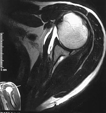 AAOS & ABOS Sports Medicine MCQs (Set 1): Knee, Shoulder & Concussion | Board Review