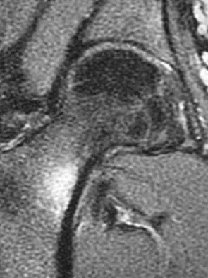Sports Medicine 2004 Practice Questions: Set 1 (Solved) - Figure 20