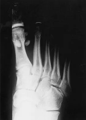 Click to enlarge Sports Medicine 2004 Practice Questions: Set 1 (Solved) - Figure 21