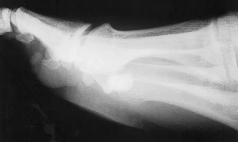 Click to enlarge Sports Medicine 2004 Practice Questions: Set 1 (Solved) - Figure 22
