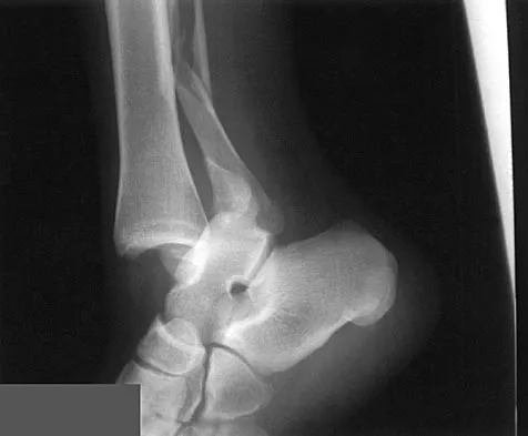 Sports Medicine 2004 Practice Questions: Set 1 (Solved) - Figure 26