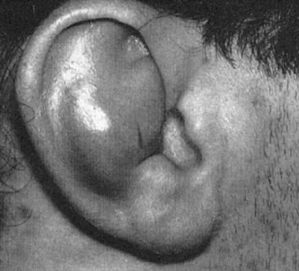 Sports Medicine 2004 Practice Questions: Set 1 (Solved) - Figure 3