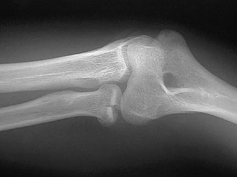 Sports Medicine 2004 Practice Questions: Set 1 (Solved) - Figure 7