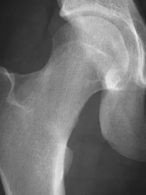 Sports Medicine 2004 Practice Questions: Set 1 (Solved) - Figure 9