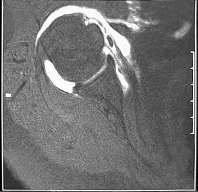 Sports Medicine Board Review 2004: High-Yield MCQs (Set 2) - Figure 7