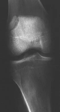 Sports Medicine Board Review 2004: High-Yield MCQs (Set 2) - Figure 8