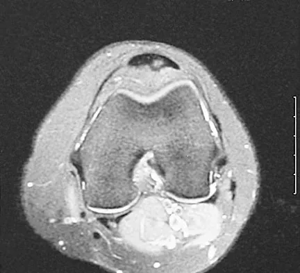 Sports Medicine 2004 Practice Questions: Set 3 (Solved) - Figure 1