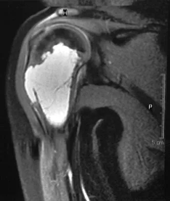 Sports Medicine 2004 Practice Questions: Set 3 (Solved) - Figure 10