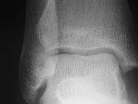 Sports Medicine 2004 Practice Questions: Set 3 (Solved) - Figure 12