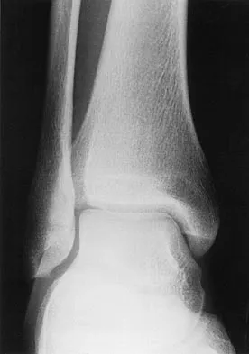 Sports Medicine 2004 Practice Questions: Set 3 (Solved) - Figure 6