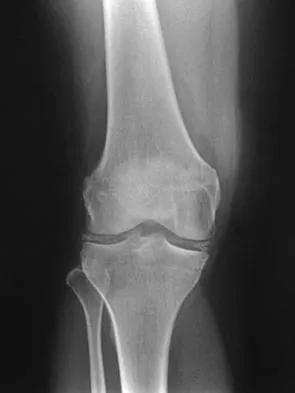 Sports Medicine 2007 Practice Questions: Set 1 (Solved) - Figure 14