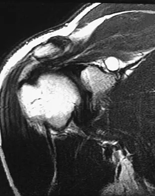 Sports Medicine 2007 Practice Questions: Set 1 (Solved) - Figure 17