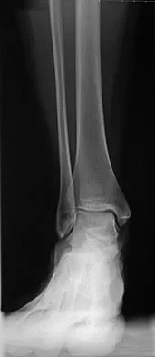 Sports Medicine 2007 Practice Questions: Set 1 (Solved) - Figure 19