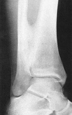 Sports Medicine 2007 Practice Questions: Set 1 (Solved) - Figure 2