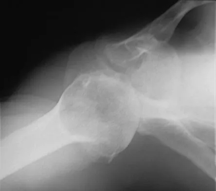 Sports Medicine 2007 Practice Questions: Set 1 (Solved) - Figure 24