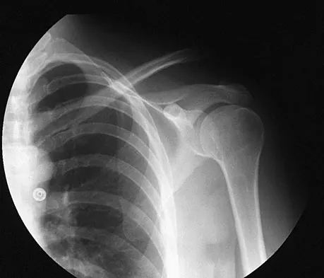 Sports Medicine 2007 Practice Questions: Set 1 (Solved) - Figure 28