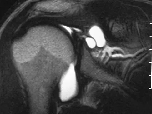 Sports Medicine 2007 Practice Questions: Set 1 (Solved) - Figure 29