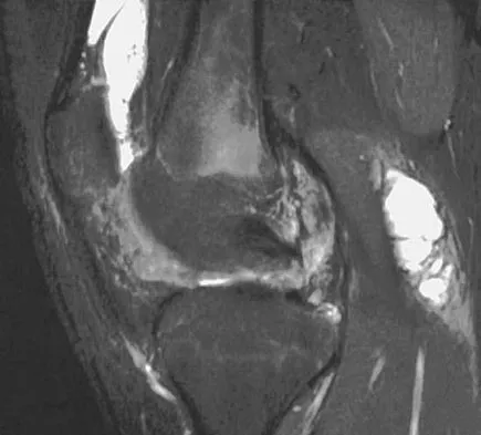 Sports Medicine 2007 Practice Questions: Set 1 (Solved) - Figure 6
